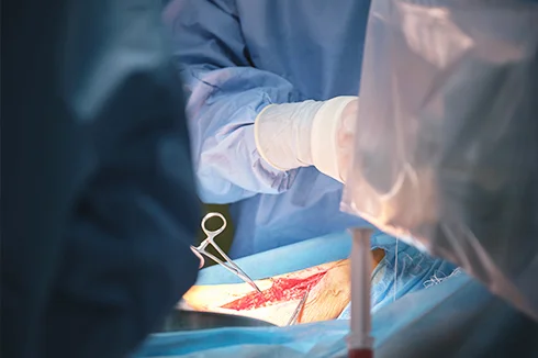 Who is a colorectal surgeon